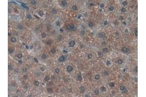 Immunohistochemistry (IHC) image for anti-Lymphotoxin beta Receptor (TNFR Superfamily, Member 3) (LTBR) (AA 66-215) antibody (ABIN7437122)