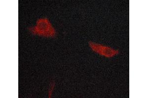 ABIN6268862 staining lovo cells by ICC/IF. (WNT1 Antikörper  (C-Term))