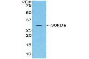 Detection of Recombinant BRCA2, Human using Polyclonal Antibody to Breast Cancer Susceptibility Protein 2 (BRCA2) (BRCA2 Antikörper  (AA 2308-2537))