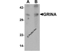Western Blotting (WB) image for anti-Glutamate Receptor, Ionotropic, N-Methyl D-Aspartate-Associated Protein 1 (Glutamate Binding) (GRINA) antibody (ABIN1077413)
