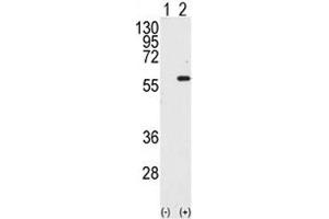 Western blot analysis of STK4 / MST1 antibody and 293 cell lysate either nontransfected (Lane 1) or transiently transfected with the STK4 gene (2). (STK4 Antikörper  (AA 385-415))