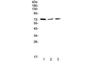 Western blot testing of human 1) HeLa, 2) MCF7 and 3) A375 cell lysate with TORC2 antibody at 0.