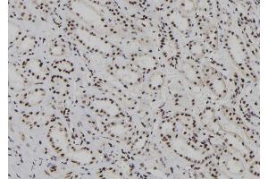 ABIN6278236 at 1/100 staining Human kidney tissue by IHC-P.