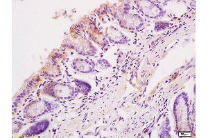 Formalin-fixed and paraffin mouse intestine tissue labeled withAnti-Sema3C/Semaphorin 3c Polyclonal Antibody, Unconjugated (ABIN720026) at 1:200, followed by conjugation to the secondary antibody and DAB staining