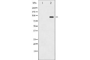 Western blot analysis of ICAM-1 phosphorylation expression in TNF-α treated HeLa whole cell lysates,The lane on the left is treated with the antigen-specific peptide. (ICAM1 Antikörper  (pTyr512))