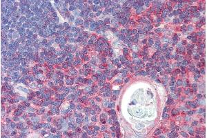 ABIN570663 (5µg/ml) staining of paraffin embedded Human Thymus. (TXK Antikörper  (C-Term))