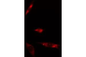 ABIN6274876 staining Hela cells by IF/ICC.