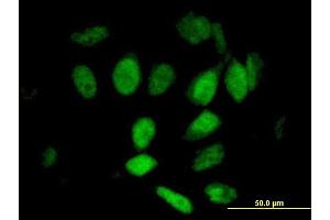 Immunofluorescence of purified MaxPab antibody to KIAA0261 on HeLa cell. (WAPAL Antikörper  (AA 1-402))