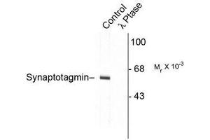 Image no. 1 for anti-Synaptotagmin I (SYT1) (pThr202) antibody (ABIN372724) (SYT1 Antikörper  (pThr202))