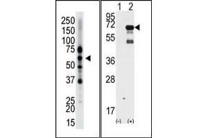 Image no. 1 for anti-Epsin 2 (EPN2) (N-Term) antibody (ABIN357623) (Epsin 2 Antikörper  (N-Term))
