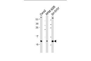 All lanes : Anti-CKS2 Antibody (N-Term) at 1:2000 dilution Lane 1: Caco2 whole cell lysate Lane 2: RI 8226 whole cell lysate Lane 3: SH-SY5Y whole cell lysate Lysates/proteins at 20 μg per lane. (CKS2 Antikörper  (AA 6-40))