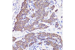 Immunohistochemistry of paraffin-embedded rat testis using UBL3 antibody (ABIN6131930, ABIN6149849, ABIN6149850 and ABIN6220468) at dilution of 1:100 (40x lens). (UBL3 Antikörper  (AA 1-117))