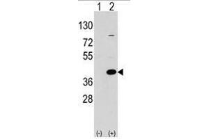 Image no. 1 for anti-Epilepsy, Progressive Myoclonus Type 2A, Lafora Disease (Laforin) (EPM2A) (C-Term) antibody (ABIN356954) (EPM2A Antikörper  (C-Term))