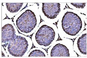 IHC analysis of CD147/Bsg using anti-CD147/Bsg antibody (ABIN7601575).