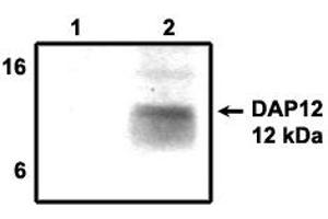 Image no. 1 for anti-TYRO Protein tyrosine Kinase Binding Protein (TYROBP) antibody (ABIN201720) (TYROBP Antikörper)
