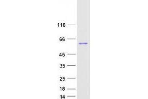 Western Blotting (WB) image for SET and MYND Domain Containing 1 (SMYD1) protein (Myc-DYKDDDDK Tag) (ABIN2732272)
