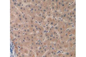 IHC-P analysis of liver tissue, with DAB staining. (Factor VIII Antikörper  (AA 2253-2346))