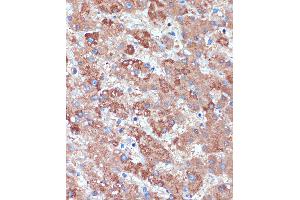 Immunohistochemistry of paraffin-embedded Human liver using B3GNT3 Rabbit pAb (ABIN7271204) at dilution of 1:100 (40x lens). (B3GNT3 Antikörper  (AA 120-240))