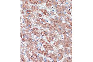Immunohistochemistry of paraffin-embedded Human liver using B3GNT3 Rabbit pAb (ABIN7271204) at dilution of 1:100 (40x lens).