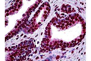 Anti-MEF2A antibody IHC of human prostate. (MEF2A Antikörper  (AA 71-170))