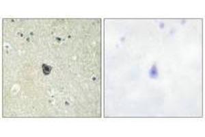 Immunohistochemistry analysis of paraffin-embedded human brain tissue using CSFR (Ab-809) antibody. (CSF1R Antikörper  (Tyr809))