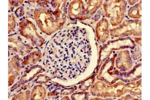 Immunohistochemistry of paraffin-embedded human kidney tissue using ABIN7169873 at dilution of 1:100 (SNRPD1 Antikörper  (AA 1-119))