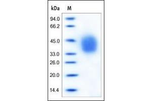 SDS-PAGE (SDS) image for Interleukin 4 Receptor (IL4R) (AA 26-232) (Active) protein (His tag) (ABIN2181320) (IL4 Receptor Protein (AA 26-232) (His tag))
