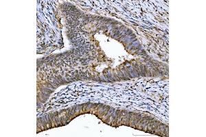 IHC analysis of THAP11 using anti-THAP11 antibody (ABIN7599230). (THAP11 Antikörper  (AA 1-294))