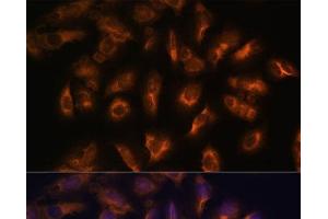 Immunofluorescence analysis of U-2 OS cells using SSTR2 Polyclonal Antibody at dilution of 1:100 (40x lens). (SSTR2 Antikörper)