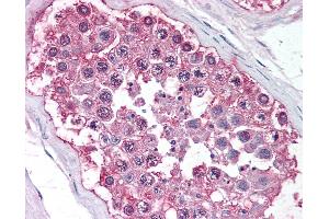 Anti-DAX1 antibody IHC of human testis. (NR0B1 Antikörper  (Ligand Binding Domain))