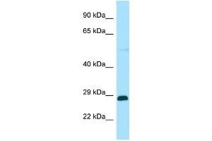 Western Blotting (WB) image for anti-RAB GTPase Activating Protein 1-Like (RABGAP1L) (Middle Region) antibody (ABIN2790497) (RABGAP1L Antikörper  (Middle Region))