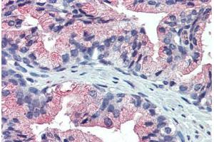 Anti-TM9SF3 antibody IHC staining of prostate, human. (TM9SF3 Antikörper  (Internal Region))