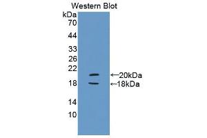 Western blot analysis of the recombinant protein. (PYGL Antikörper  (AA 603-750))