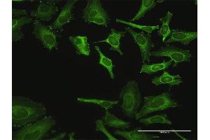 Immunofluorescence of purified MaxPab antibody to ZYX on HeLa cell. (ZYX Antikörper  (AA 1-572))