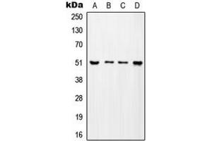 Western blot analysis of ADA2A expression in MCF7 (A), SP2/0 (B), H9C2 (C), mouse testis (D) whole cell lysates. (TADA2L Antikörper  (Center))