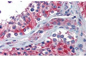 Immunohistochemistry with Human Testis lysate tissue at an antibody concentration of 5. (NPY1R Antikörper  (Middle Region))