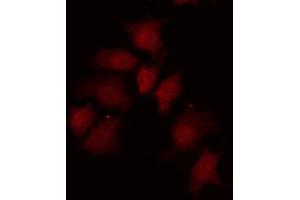Immunofluorescence (fixed cells) (IF/ICC) image for anti-Myc Proto-Oncogene protein (MYC) (pSer62) antibody (ABIN6255431)