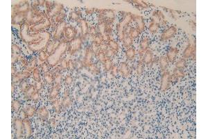 IHC-P analysis of Mouse Kidney Tissue, with DAB staining. (PLXNB1 Antikörper  (AA 1598-1849))
