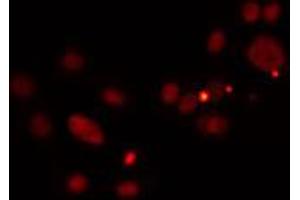 ABIN6274511 staining HuvEc cells by IF/ICC. (PRDM12 Antikörper  (Internal Region))