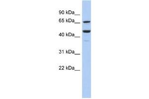 WB Suggested Anti-SF1 Antibody Titration:  0. (Splicing Factor 1 Antikörper  (Middle Region))
