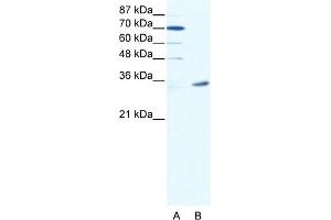 WB Suggested Anti-MAGEA9 Antibody Titration:  2. (MAGEA9 Antikörper  (N-Term))