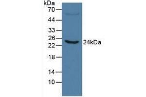 Detection of CRP in Human Serum using Monoclonal Antibody to C Reactive Protein (CRP) (CRP Antikörper  (AA 20-225))
