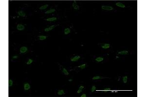 Immunofluorescence of monoclonal antibody to CRTC1 on HeLa cell. (CRTC1 Antikörper  (AA 553-634))
