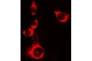 ABIN6276748 staining 293 cells by IF/ICC. (BAD Antikörper  (Internal Region))