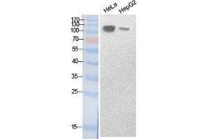 Western Blotting (WB) image for anti-Sterol Regulatory Element Binding Transcription Factor 1 (SREBF1) (Internal Region) antibody (ABIN3187988) (SREBF1 Antikörper  (Internal Region))