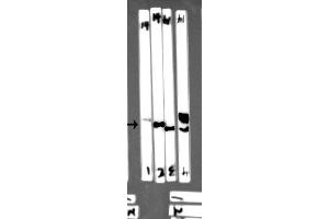 Western blot analysis of extracts from Mouse spleen tissue,Rat spleen tissue,HEK293 and 293T cells, using EFNB2 antibody (df7450) at 1/1000 dilution. (Ephrin B2 Antikörper  (C-Term))