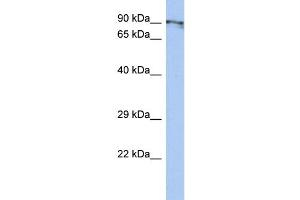 WB Suggested Anti-CXorf20 Antibody Titration: 0. (BEND2 Antikörper  (Middle Region))