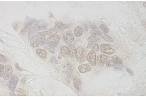 anti-Aquarius Homolog (AQR) (AA 1435-1485) antibody