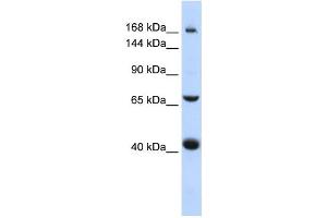 Western Blotting (WB) image for anti-ATP-Binding Cassette, Sub-Family C (CFTR/MRP), Member 9 (ABCC9) antibody (ABIN2458769) (ABCC9 Antikörper)