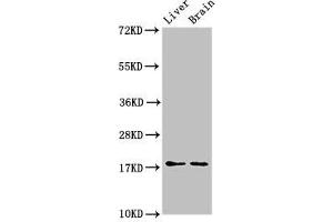 Western Blot Positive WB detected in: Mouse liver tissue, Mouse brain tissue All lanes: HSPB6 antibody at 3 μg/mL Secondary Goat polyclonal to rabbit IgG at 1/50000 dilution Predicted band size: 18 kDa Observed band size: 18 kDa (HSPB6 Antikörper  (AA 1-160))